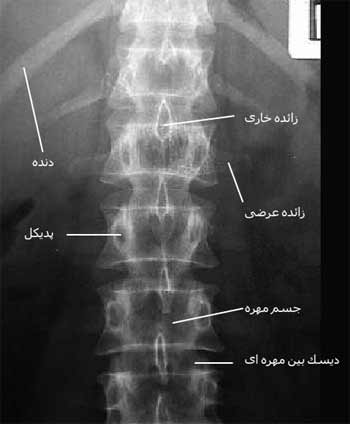 رادیوگرافی رخ ستون مهره کمری