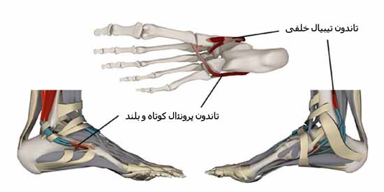 تاندون های مچ پا