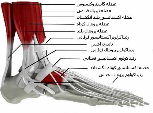 تاندون های کچ پا