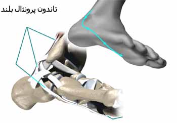 تاندون های کچ پا