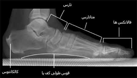 نمای نیمرخ استخوان های پا در حالت ایستاده