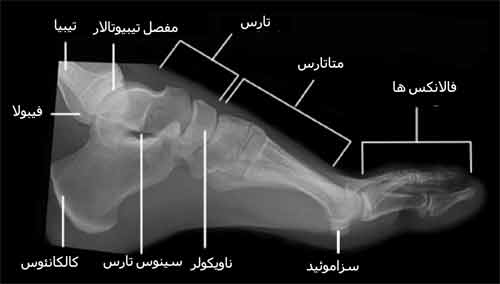 نمای نیمرخ استخوان های پا