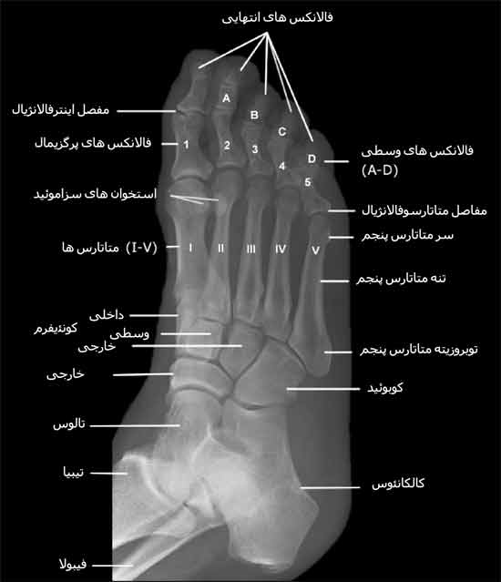 نمای مایل استخوان های پا
