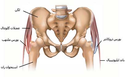 بورسیت تروکانتر در لگن