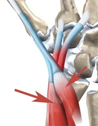 محل تقاطع عضلات در مچ دست