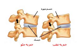 دیسک بین مهره ای