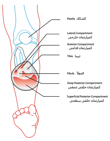 سطح مقطع ساق