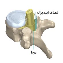 فضای اپیدورال