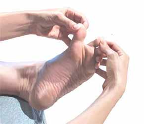 مراقبت از زخم پای دیابتی